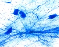 Nerve cell smear (1)