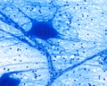Nerve cell smear (4)