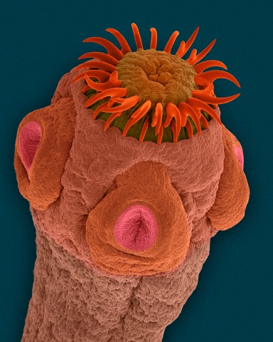 какие черви живут в организме человека фото | Дзен