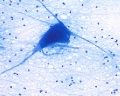 Nerve cell smear (3)
