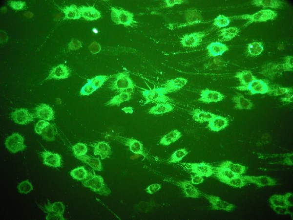 Фитопланктон вес. Микобактерии туберкулеза люминесцентная микроскопия. Хламидии люминесцентная микроскопия. Люминесцентная микроскопия микробиология. Метод люминесцентной микроскопии.