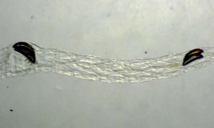 коретра мешки.jpg коретра мешки.jpg