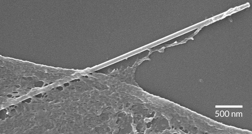Человеческая клетка, поглощающая кремниевую нанопроволоку. Фото: Zimmerman et al., Science Advances 16 Dec 2016: Vol.2, no. 12, e1601039