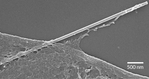Человеческая клетка, поглощающая кремниевую нанопроволоку. Фото: Zimmerman et al., Science Advances 16 Dec 2016: Vol.2, no. 12, e1601039 Человеческая клетка, поглощающая кремниевую нанопроволоку. Фото: Zimmerman et al., Science Advances 16 Dec 2016: Vol.2, no. 12, e1601039