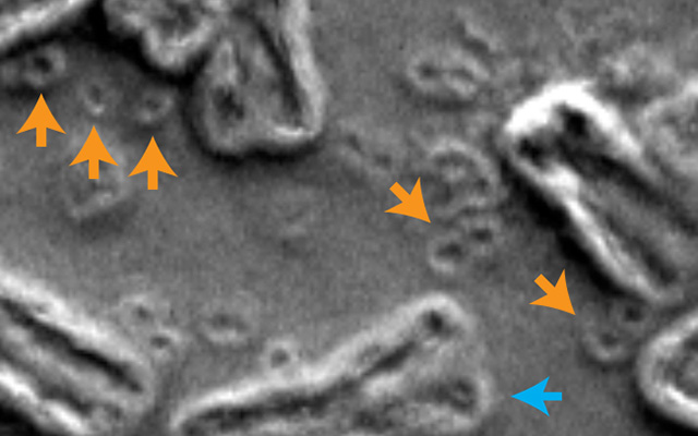 кольцевая ДНК раковые клетки.jpg