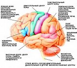 Сосудистые заболевания мозга. Все может начаться с головной боли