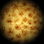 Иммунитет нападает на раковые клетки из засады