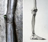 Кости из Лондона доказали отравление римлян свинцом